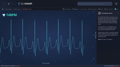 ecg porn|ECG